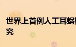 世界上首例人工耳蜗植入及其对言语影响的研究