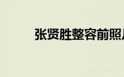 张贤胜整容前照片（张贤胜整容）