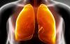 白藜芦醇可减少肺部的氧化应激
