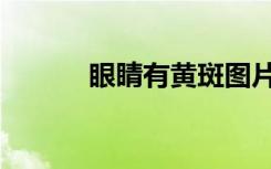 眼睛有黄斑图片（眼睛有黄斑）