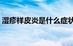 湿疹样皮炎是什么症状（湿疹样皮炎的症状）