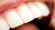 西方牙科护理不能解决您牙齿问题的原因