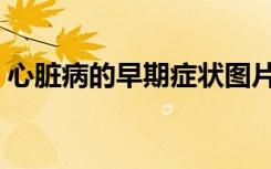 心脏病的早期症状图片（心脏病的早期症状）
