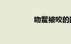 吻鳖被咬的图片（吻鳖）