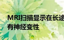 MRI扫描显示在长途飞行中大脑会重组 但没有神经变性