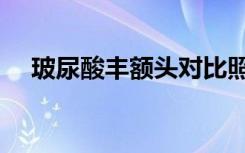 玻尿酸丰额头对比照片（玻尿酸丰额头）
