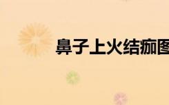 鼻子上火结痂图片（鼻子上火）