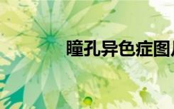 瞳孔异色症图片（瞳孔异色）