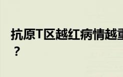 抗原T区越红病情越重？感染后怎样才算康复？