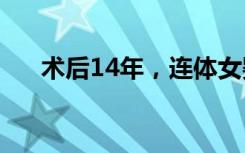 术后14年，连体女婴长成健康姐妹花！