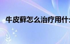 牛皮藓怎么治疗用什么药（牛皮藓怎么治）