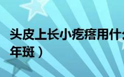 头皮上长小疙瘩用什么洗发水好（头皮上长老年斑）