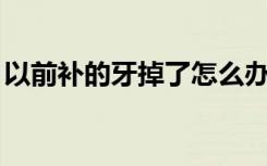 以前补的牙掉了怎么办（一q币等于多少q点）