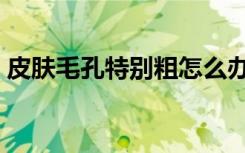 皮肤毛孔特别粗怎么办（皮肤毛孔粗怎么办）