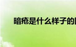 暗疮是什么样子的图片（暗疮是什么）
