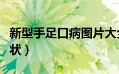新型手足口病图片大全（新型手足口病初期症状）