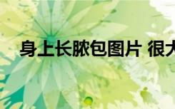 身上长脓包图片 很大（身上长脓包图片）