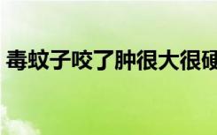 毒蚊子咬了肿很大很硬多久消下去（毒蚊子）
