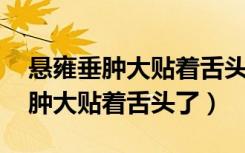 悬雍垂肿大贴着舌头了 吞咽有异物（悬雍垂肿大贴着舌头了）
