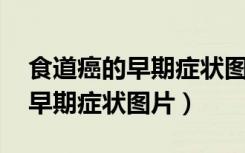 食道癌的早期症状图片 晚期图片（食道癌的早期症状图片）