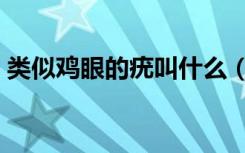 类似鸡眼的疣叫什么（类似鸡眼的疣怎么治）