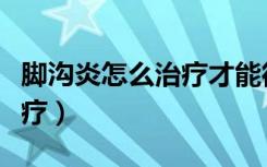 脚沟炎怎么治疗才能彻底根除（脚沟炎怎么治疗）