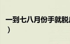 一到七八月份手就脱皮（季节性手脱皮怎么治）