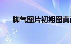 脚气图片初期图真菌（脚气图片初期）