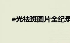 e光祛斑图片全纪录（e光祛斑怎么样）