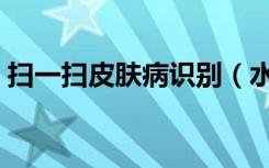 扫一扫皮肤病识别（水土不服的症状丘疹图）