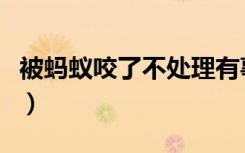 被蚂蚁咬了不处理有事吗（被蚂蚁咬了怎么办）