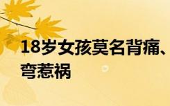 18岁女孩莫名背痛、胸闷，一查竟是脊柱侧弯惹祸