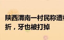 陕西渭南一村民称遭村支书带人殴打，多处骨折，牙也被打掉