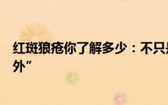 红斑狼疮你了解多少：不只是红斑，是免疫系统的一次“意外”