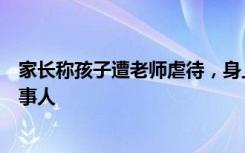 家长称孩子遭老师虐待，身上都是甲印抠痕，警方已控制涉事人