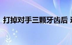 打掉对手三颗牙齿后 辽宁男篮付豪发文道歉