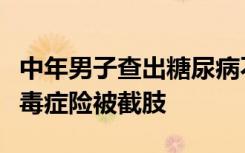中年男子查出糖尿病不坚持治疗，八年后患尿毒症险被截肢