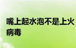 嘴上起水泡不是上火！小心是这种终身潜伏的病毒