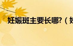 妊娠斑主要长哪?（妊娠斑什么样子图片）
