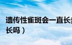 遗传性雀斑会一直长多吗（遗传性雀斑会一直长吗）