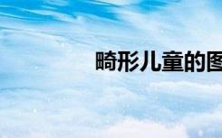 畸形儿童的图片（畸形儿）