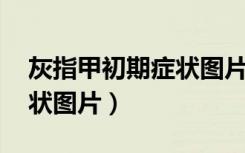 灰指甲初期症状图片 早期（灰指甲的初期症状图片）