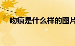 吻痕是什么样的图片真实（吻痕是什么）