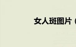 女人斑图片（女人b图片）