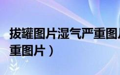 拔罐图片湿气严重图片大全（拔罐图片湿气严重图片）