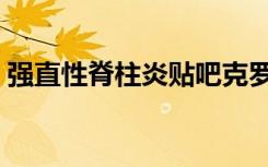 强直性脊柱炎贴吧克罗（强直性脊柱炎贴吧）