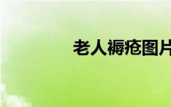 老人褥疮图片（褥疮图片）