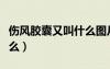 伤风胶囊又叫什么图片板装（伤风胶囊又叫什么）
