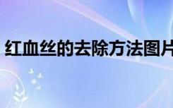 红血丝的去除方法图片（红血丝的去除方法）