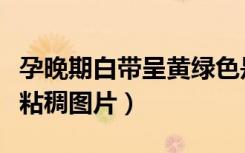 孕晚期白带呈黄绿色是怎么回事（白带黄绿色粘稠图片）